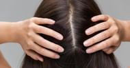 Scalp scabs (Image via Getty Images)